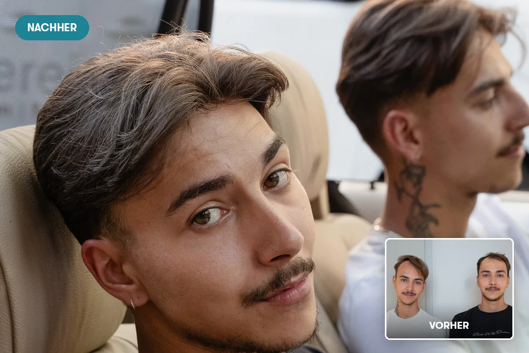 Die Zwillinge Jan und Nick mit ihrem O.C. Haarsystem, dazu beide vorher