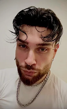 Abdu mit seinem O.C. Haarsystem