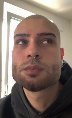 Abdu vor dem Haarsystem