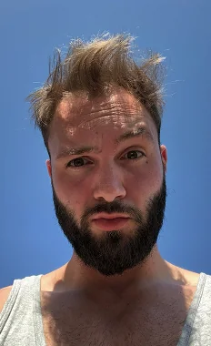 Chris vor dem Haarsystem