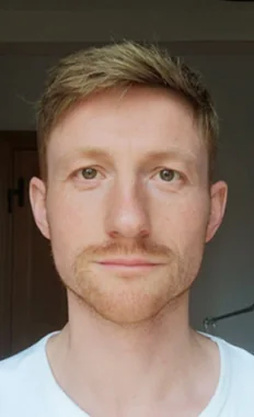 Felix mit seinem O.C. Haarsystem