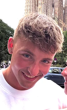 Hannes mit seinem O.C. Haarsystem