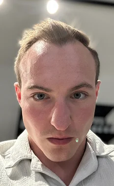 Hannes vor dem Haarsystem
