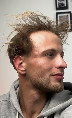 Ian vor dem Haarsystem