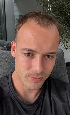 Maurice vor dem Haarsystem