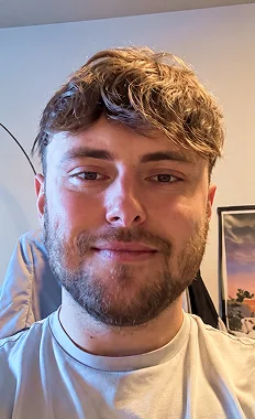 Max mit seinem O.C. Haarsystem