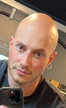 Max vor dem Haarsystem