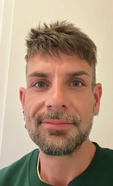Serkan mit seinem O.C. Haarsystem