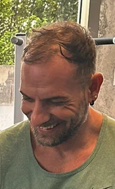 Serkan vor dem Haarsystem
