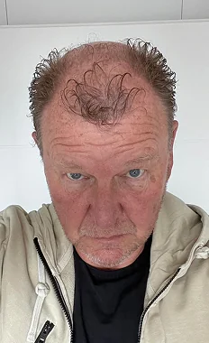 Wolfgang vor dem Haarsystem