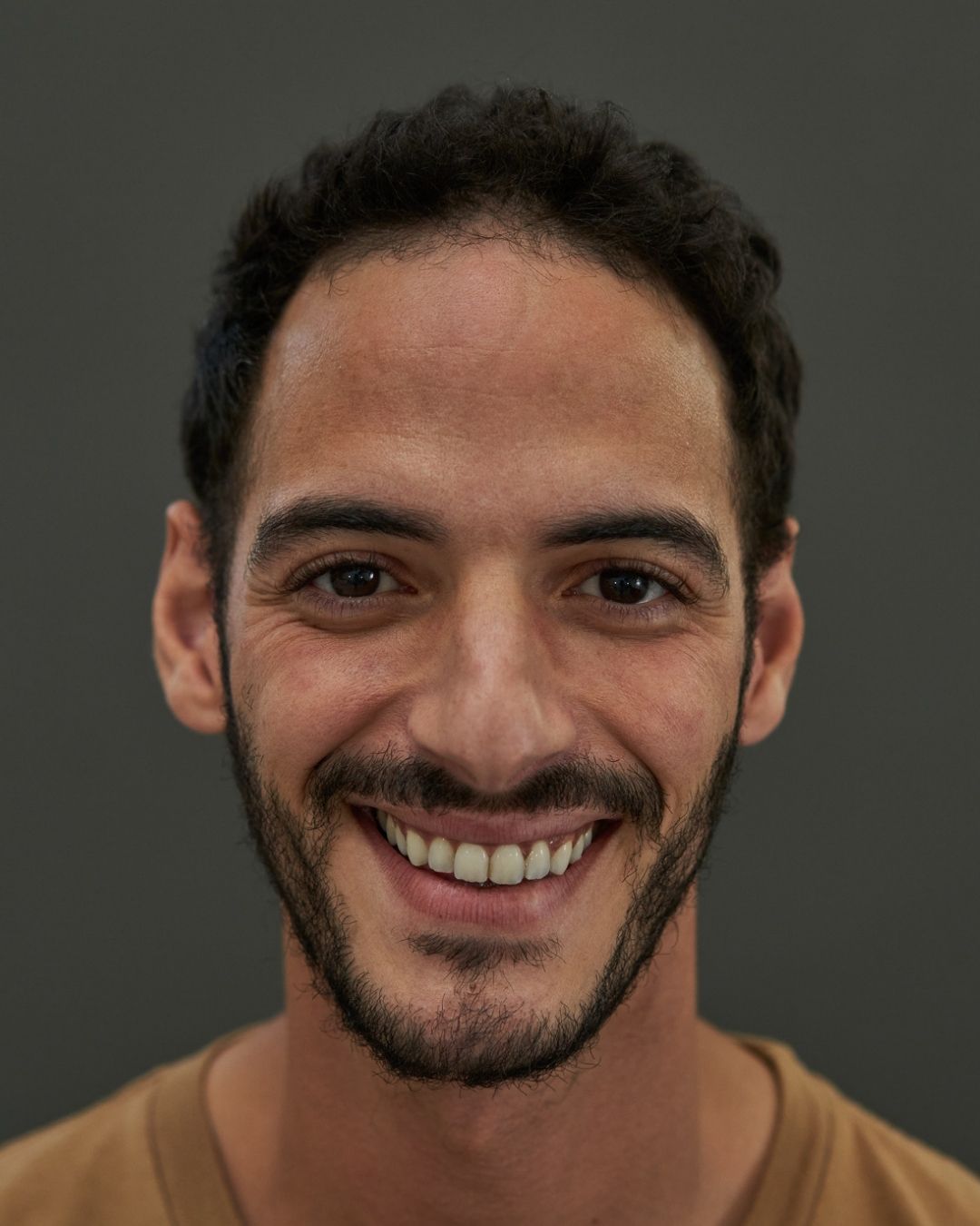 Our O.C. Model Rafique | Transformations of customers with hair system
