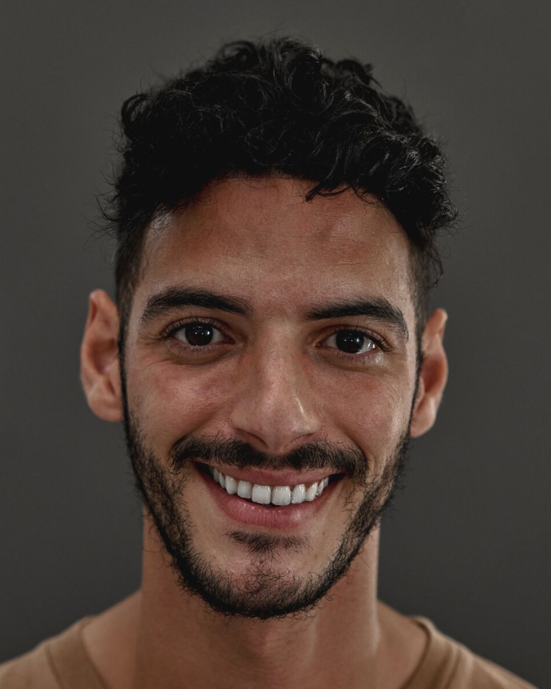 Our O.C. Model Rafique | Transformations of customers with hair system
